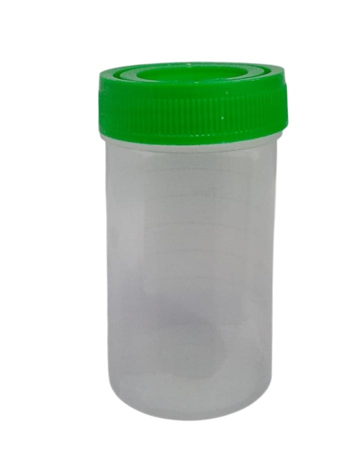 URINE SAMPLE CONTAINER